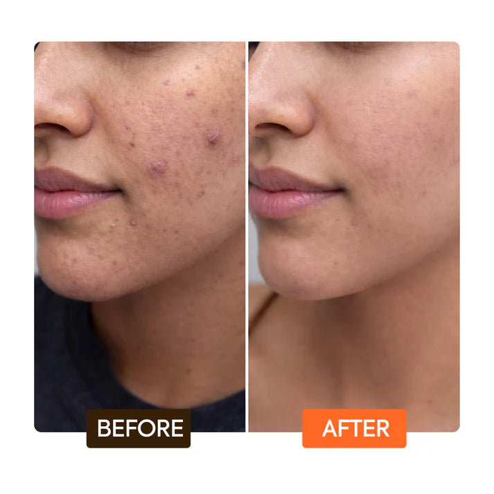 NATURALLE CAROTONIC EXTREME GLOW RENEWING FACE SERUM
