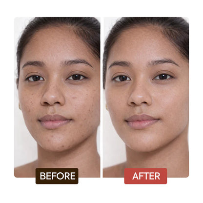 NATURALLE INTENSE EXTREME GLOW REJUVENATING COMPLEXION SOAP