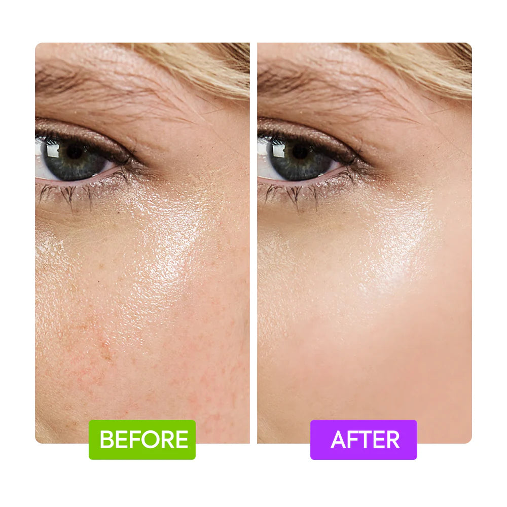 20% AHA + 10% NIACINAMIDE BOOSTER - IYKYK