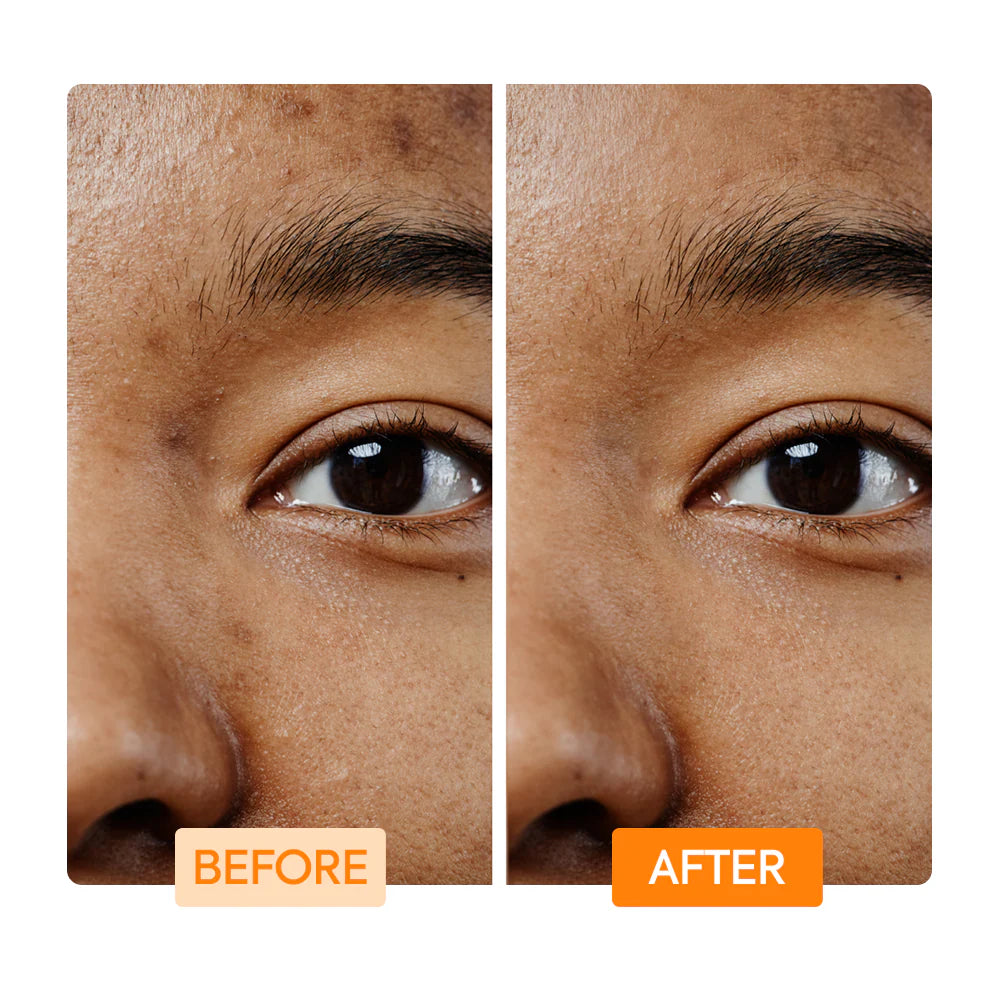 VITAMIN C & TUMERIC FACIAL CLEANSING BAR - IYKYK